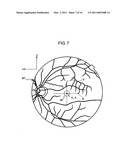 FUNDUS OCULI OBSERVING DEVICE diagram and image