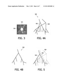 SEGMENTING PULMONARY ARTERIES diagram and image