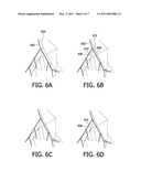 SEGMENTING PULMONARY ARTERIES diagram and image