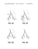 SEGMENTING PULMONARY ARTERIES diagram and image