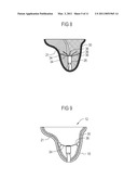 Hearing aid device and a method of manufacturing a hearing aid device diagram and image