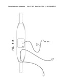 Biologically fit wearable electronics apparatus and methods diagram and image