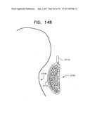 Biologically fit wearable electronics apparatus and methods diagram and image