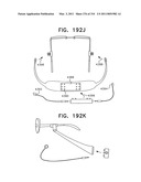 Biologically fit wearable electronics apparatus and methods diagram and image