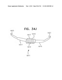 Biologically fit wearable electronics apparatus and methods diagram and image