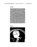 ITERATIVE CT IMAGE FILTER FOR NOISE REDUCTION diagram and image