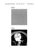 ITERATIVE CT IMAGE FILTER FOR NOISE REDUCTION diagram and image