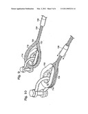 Thimble with element retaining feature diagram and image