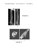 CERAMIC SCAFFOLDS FOR BONE REPAIR diagram and image