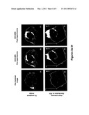 TREATMENTS OF DISEASE OR DISORDERS USING NANOPARTICLES FOR FOCUSED HYPERTHERMIA TO INCREASE THERAPY EFFICACY diagram and image