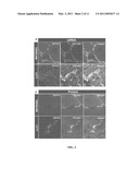 MODULATION OF SRPX2-MEDIATED ANGIOGENESIS diagram and image