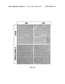 MODULATION OF SRPX2-MEDIATED ANGIOGENESIS diagram and image