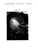 CARTILAGE COMPOSITION AND PROCESS FOR PRODUCING THE CARTILAGE COMPOSITION diagram and image