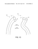 Temperature Responsive Smart Textile diagram and image