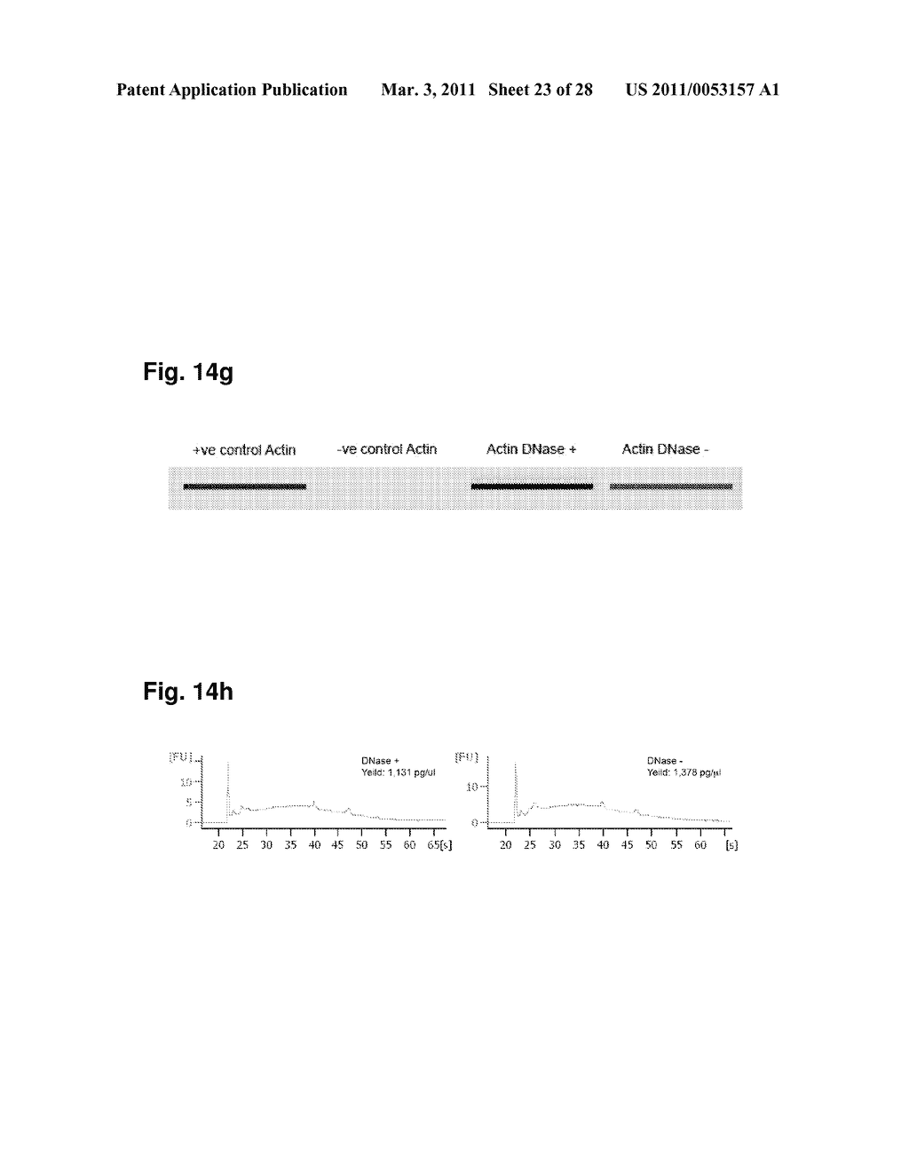 USE OF MICROVESICLES IN DIAGNOSIS, PROGNOSIS AND TREATMENT OF MEDICAL DISEASES AND CONDITIONS - diagram, schematic, and image 24