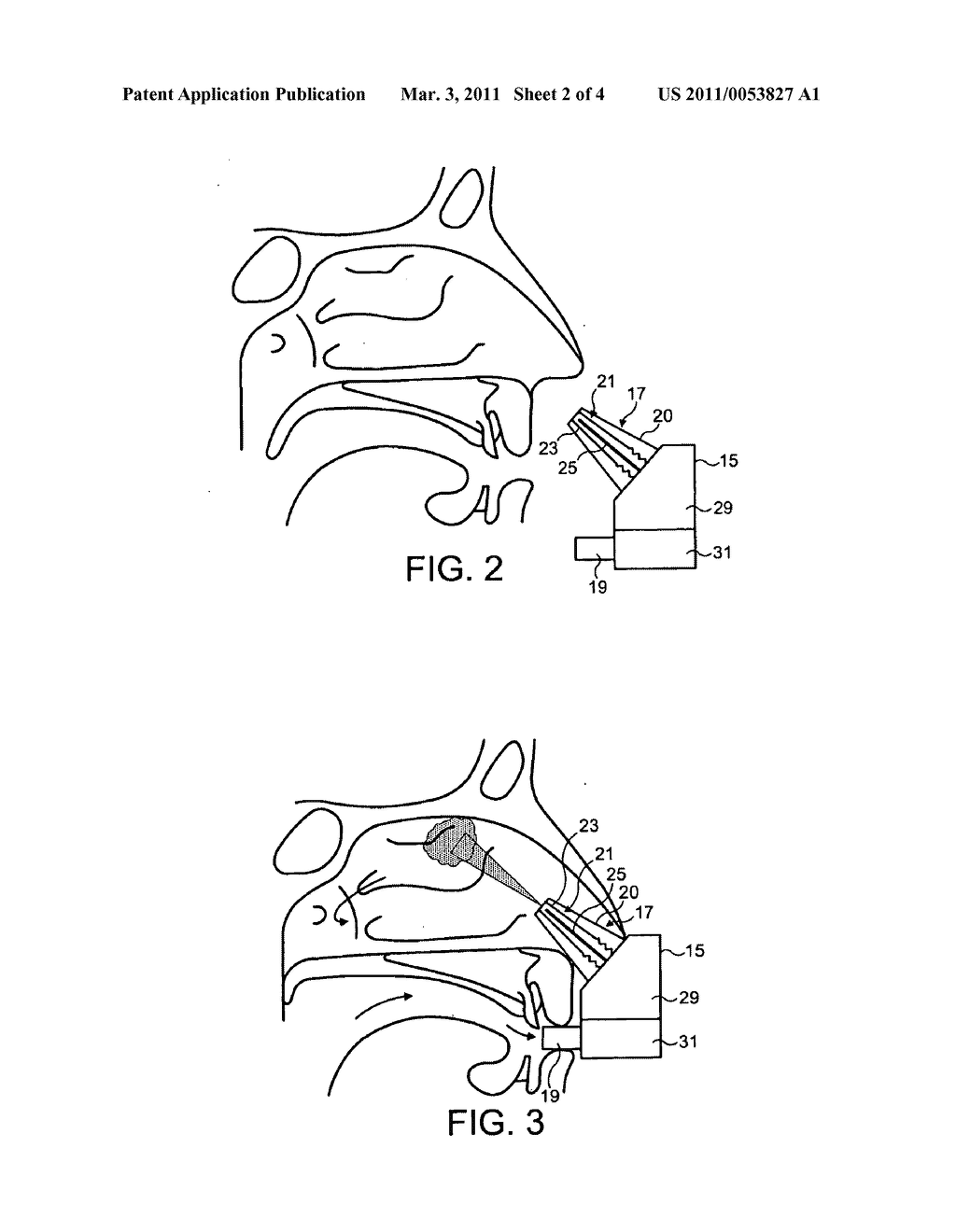 INTRANASAL ADMINISTRATION - diagram, schematic, and image 03