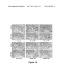 METHODS OF REGULATING ACTIN CYTOSKELETAL REARRANGEMENT AND INTERCELLULAR GAP FORMATION diagram and image