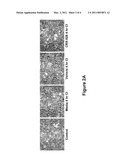 METHODS OF REGULATING ACTIN CYTOSKELETAL REARRANGEMENT AND INTERCELLULAR GAP FORMATION diagram and image