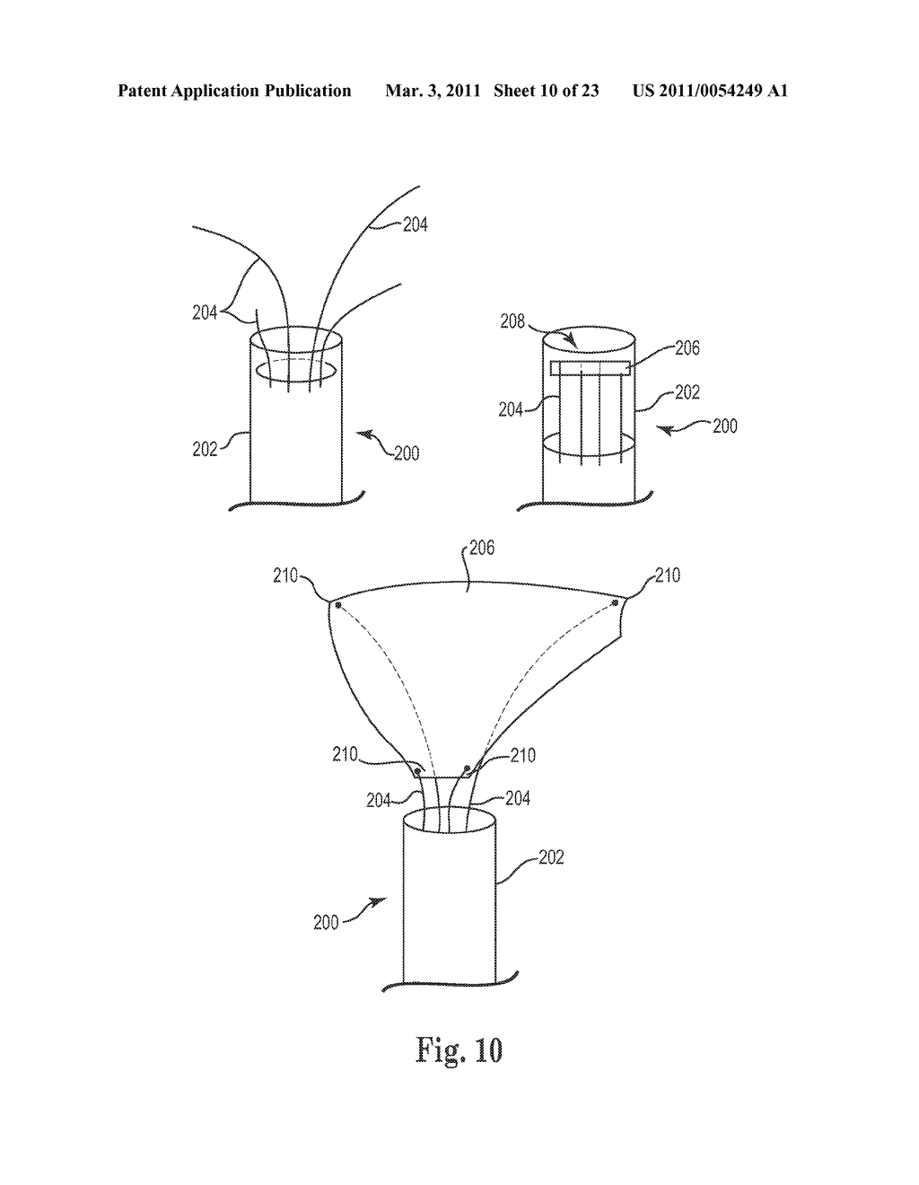 APPARATUS, SYSTEM AND METHOD OF MINIMALLY INVASIVE REPAIR OF PELVIC ORGAN PROLAPSE - diagram, schematic, and image 11