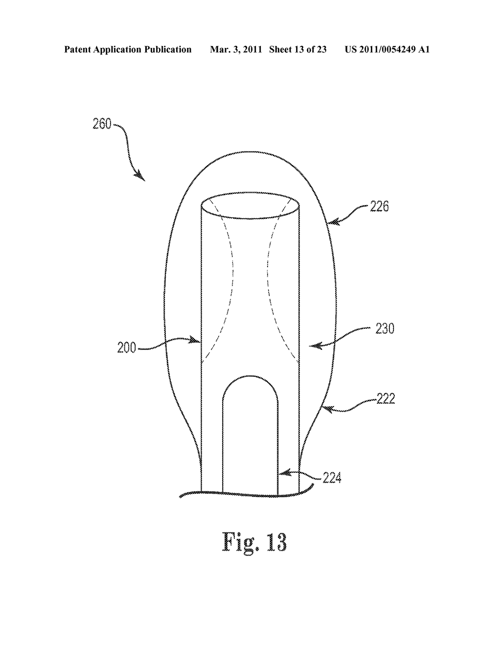 APPARATUS, SYSTEM AND METHOD OF MINIMALLY INVASIVE REPAIR OF PELVIC ORGAN PROLAPSE - diagram, schematic, and image 14