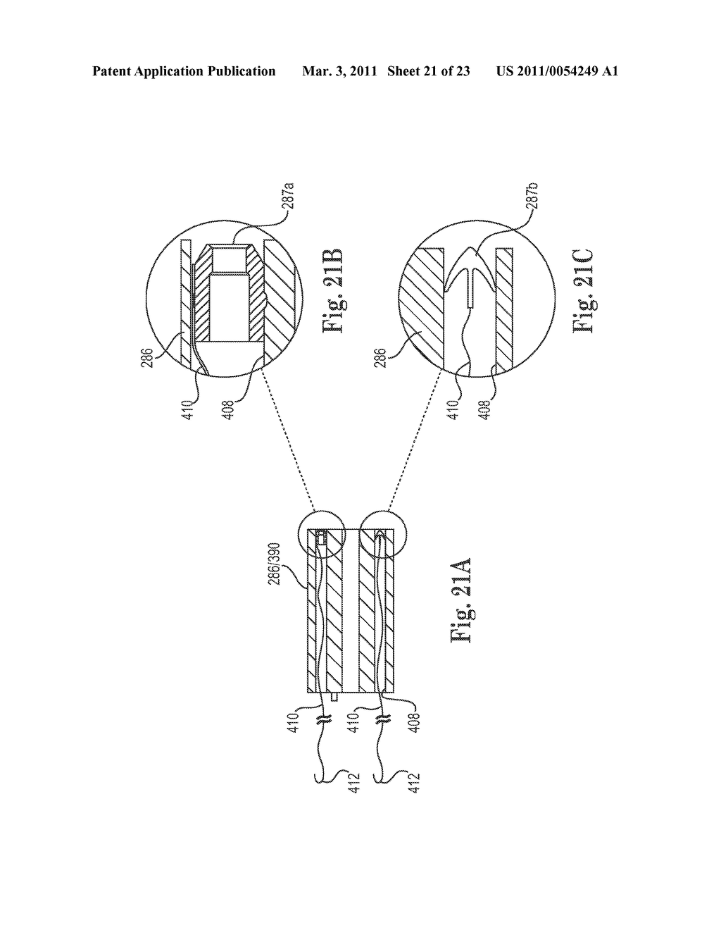 APPARATUS, SYSTEM AND METHOD OF MINIMALLY INVASIVE REPAIR OF PELVIC ORGAN PROLAPSE - diagram, schematic, and image 22