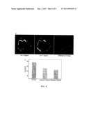 Method, System, and Computer-Accessible Medium for Assessment of Glycosaminoglycan Concentration in Vivo by Chemical Exchange Saturation Transfer diagram and image