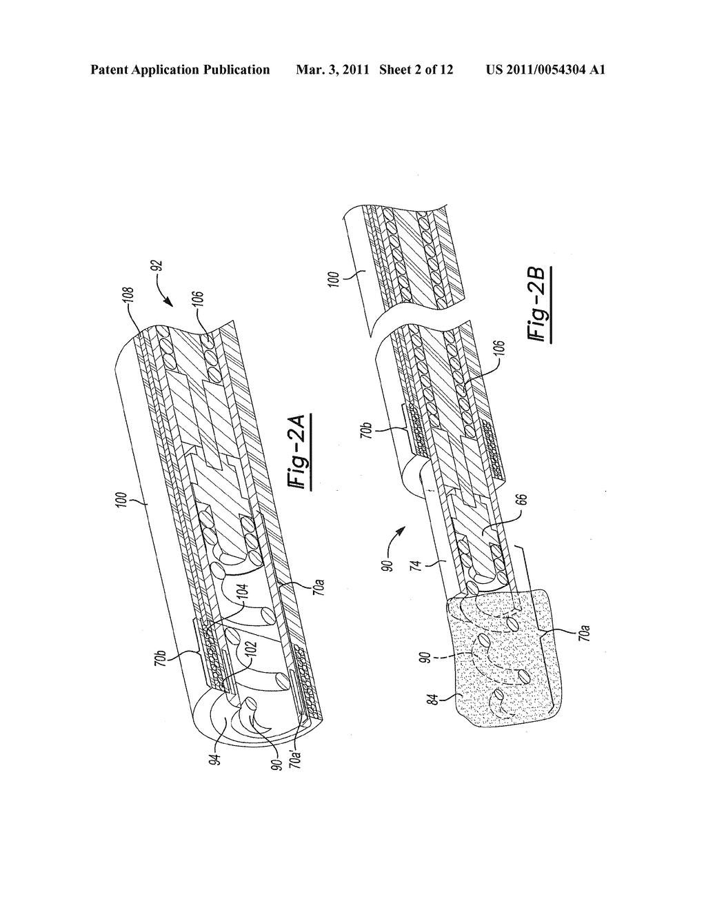 Combination Localization System - diagram, schematic, and image 03