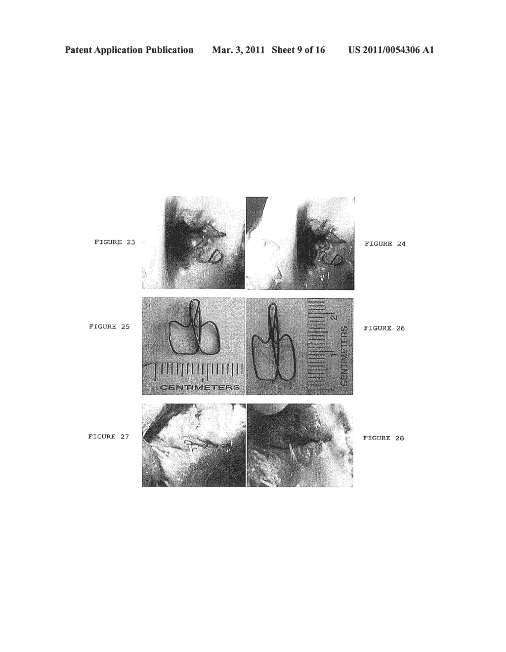 TISSUE CLIP - diagram, schematic, and image 10