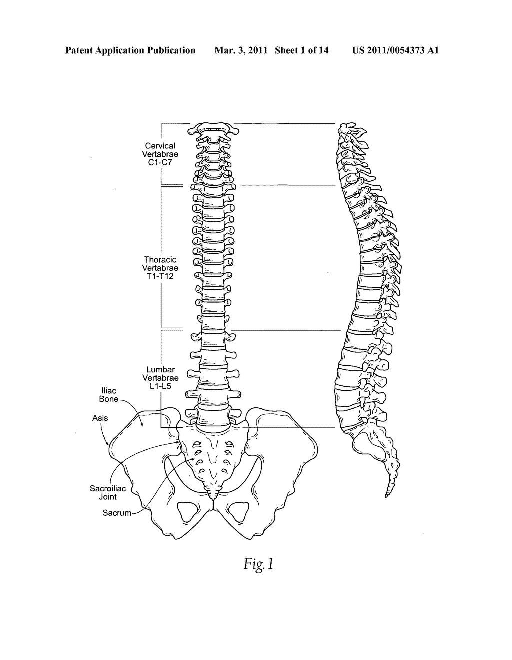 Systems, devices, and methods for diagnosing and treating conditions of the spine - diagram, schematic, and image 02