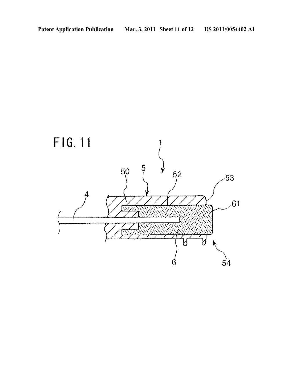 INDWELLING NEEDLE ASSEMBLY AND METHOD OF USING THE SAME - diagram, schematic, and image 12