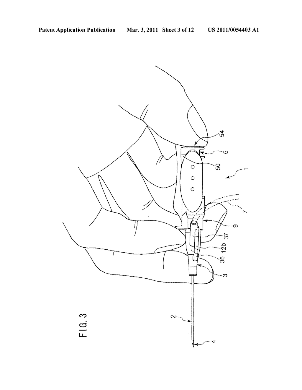 INDWELLING NEEDLE ASSEMBLY AND METHOD OF USING THE SAME - diagram, schematic, and image 04