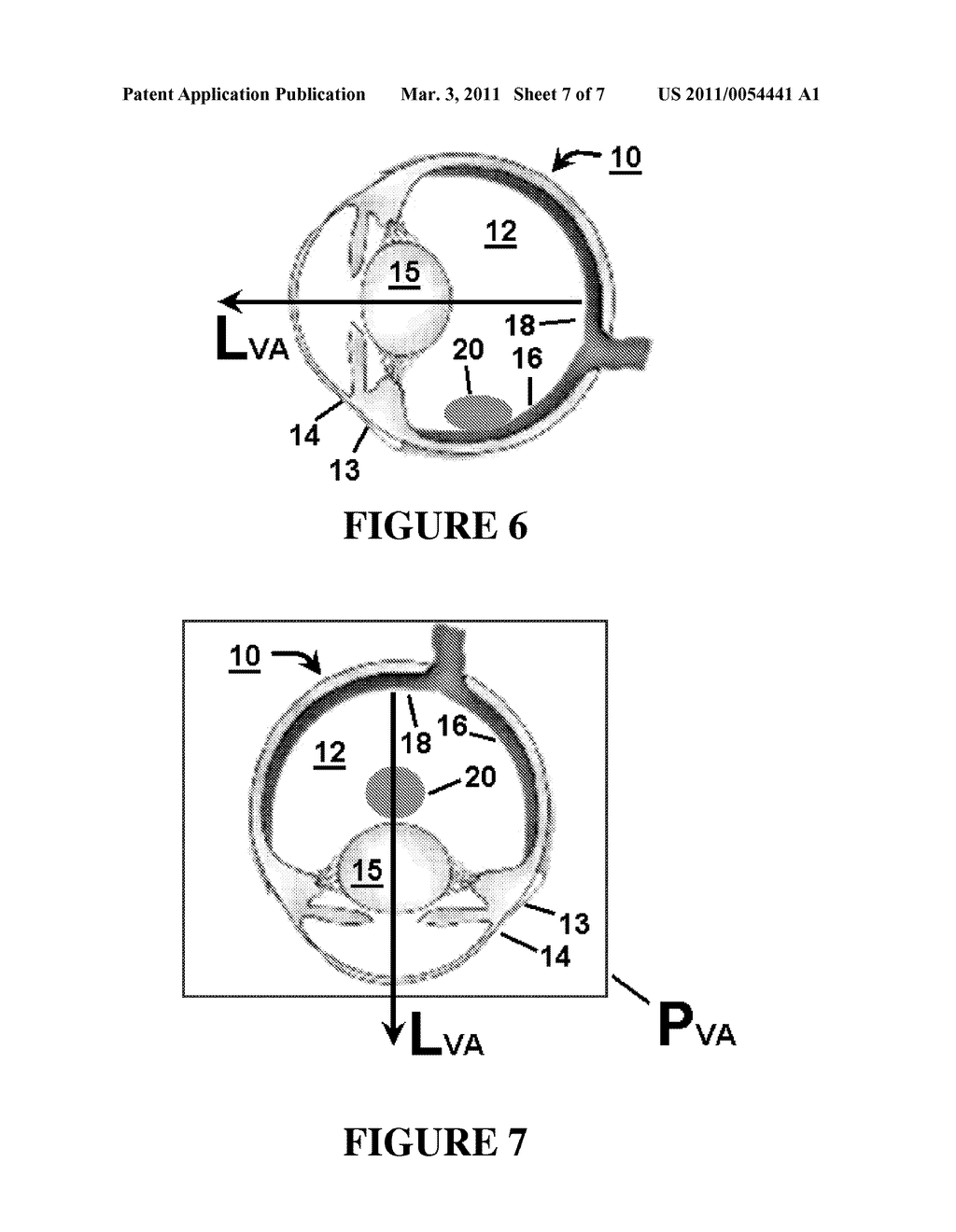 METHODS, DEVICES, AND COMPOSITIONS FOR INTRAVITREAL INJECTION - diagram, schematic, and image 08