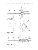 SYSTEMS FOR TREATING A HOLLOW ANATOMICAL STRUCTURE diagram and image