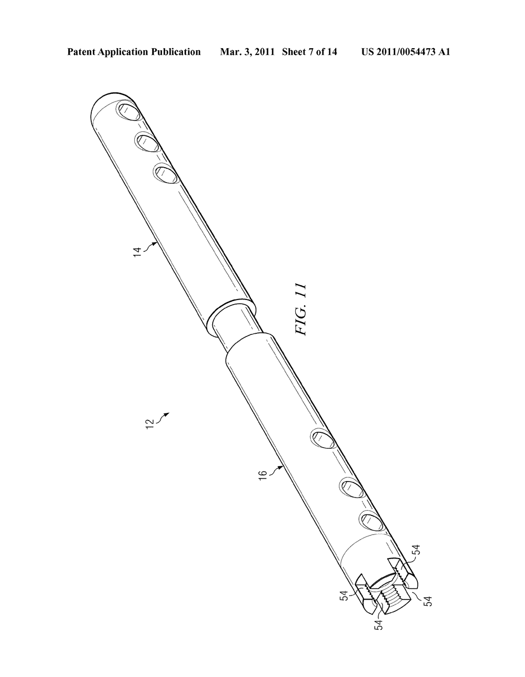 ANKLE ARTHRODESIS NAIL AND OUTRIGGER ASSEMBLY - diagram, schematic, and image 08