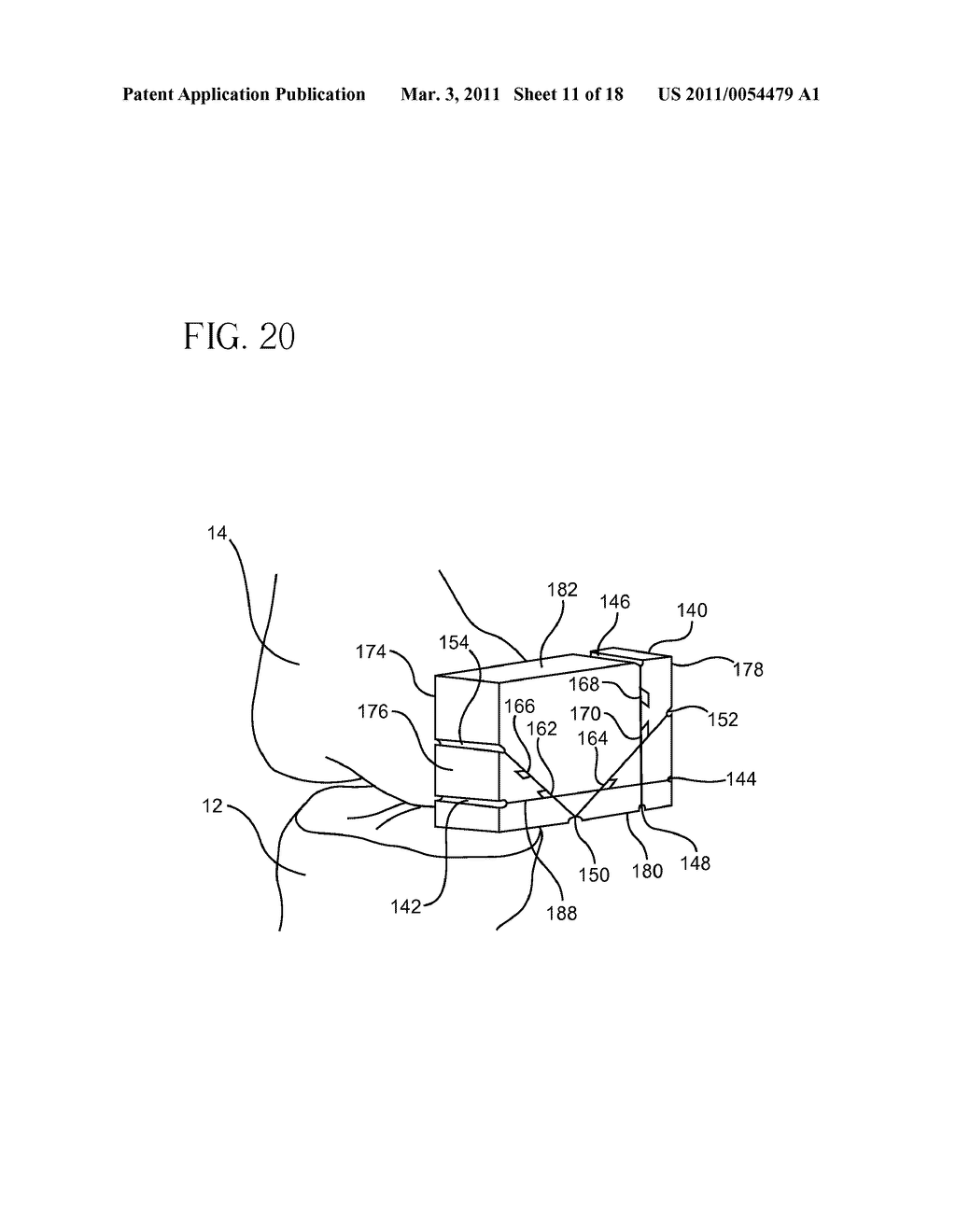 METHOD FOR ARTHROSCOPIC BONE PREPARATION - diagram, schematic, and image 12