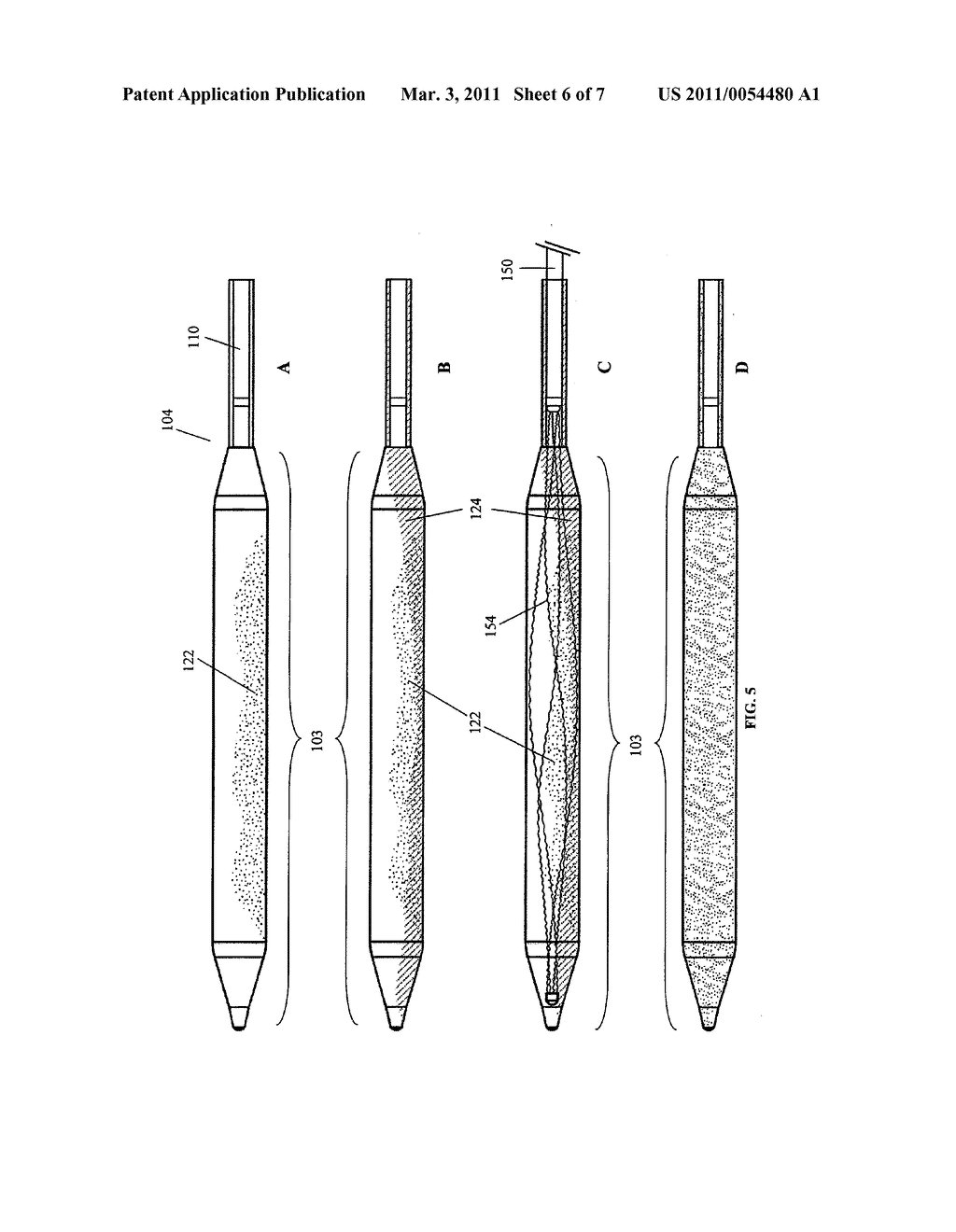 Internal Bone Fixation System with Integrated Mixer - diagram, schematic, and image 07