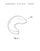 Devices, Methods, and Systems for Prosthetic Meniscus Selection, Trialing, and Implantation diagram and image