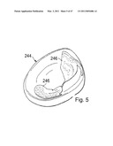 Devices, Methods, and Systems for Prosthetic Meniscus Selection, Trialing, and Implantation diagram and image