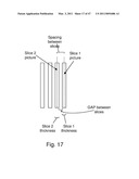 Devices, Methods, and Systems for Prosthetic Meniscus Selection, Trialing, and Implantation diagram and image