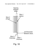 Devices, Methods, and Systems for Prosthetic Meniscus Selection, Trialing, and Implantation diagram and image