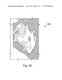 Devices, Methods, and Systems for Prosthetic Meniscus Selection, Trialing, and Implantation diagram and image