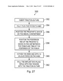 Devices, Methods, and Systems for Prosthetic Meniscus Selection, Trialing, and Implantation diagram and image