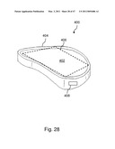 Devices, Methods, and Systems for Prosthetic Meniscus Selection, Trialing, and Implantation diagram and image