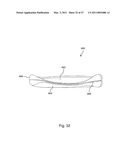 Devices, Methods, and Systems for Prosthetic Meniscus Selection, Trialing, and Implantation diagram and image