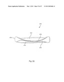 Devices, Methods, and Systems for Prosthetic Meniscus Selection, Trialing, and Implantation diagram and image