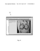 Devices, Methods, and Systems for Prosthetic Meniscus Selection, Trialing, and Implantation diagram and image