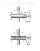 COAXIAL TRANSSEPTAL GUIDE-WIRE AND NEEDLE ASSEMBLY diagram and image