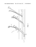 VASCULAR CLIP diagram and image