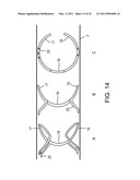 VASCULAR CLIP diagram and image