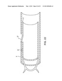 VASCULAR CLIP diagram and image